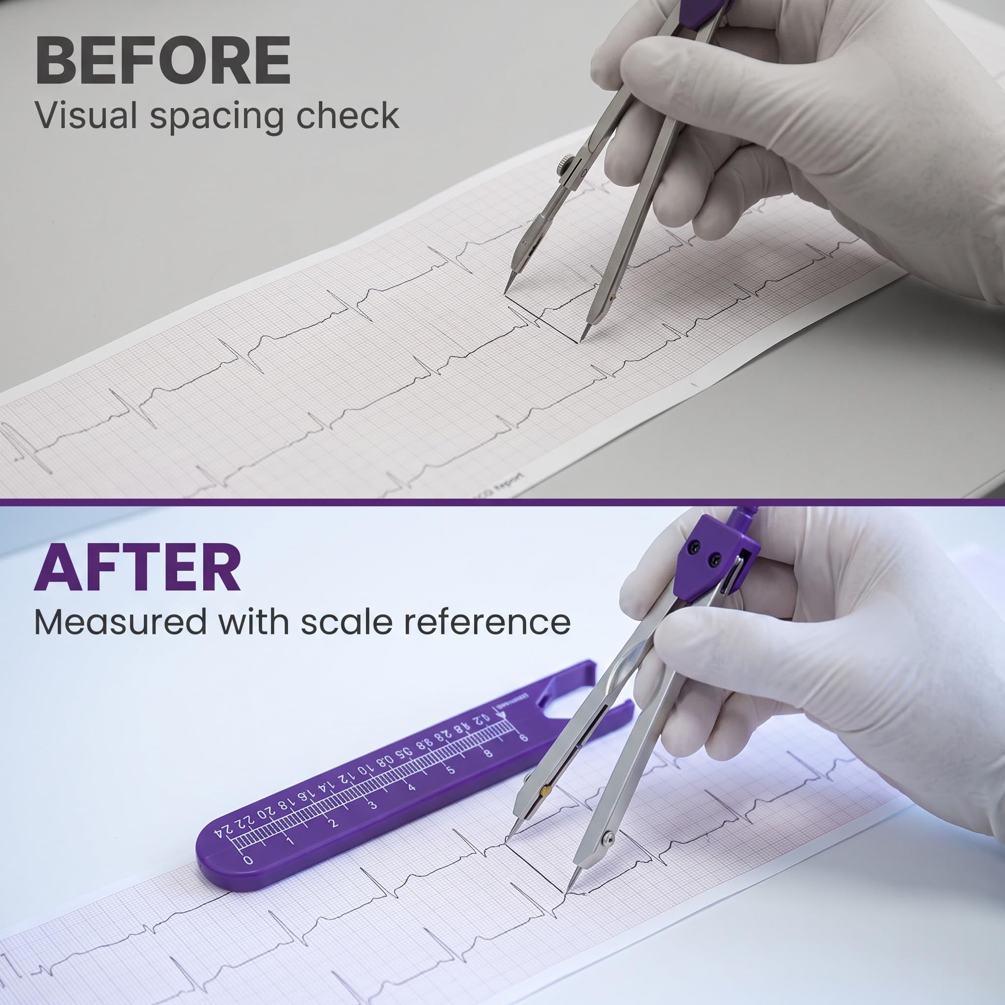 EKG Calipers - Precise Measurement Tool -8 EKG Calipers - Precise Measurement Tool -8
