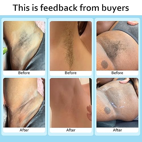 Wax Warmer Kit for Hair Removal at Home - All Skin Types(Black Kit 2)