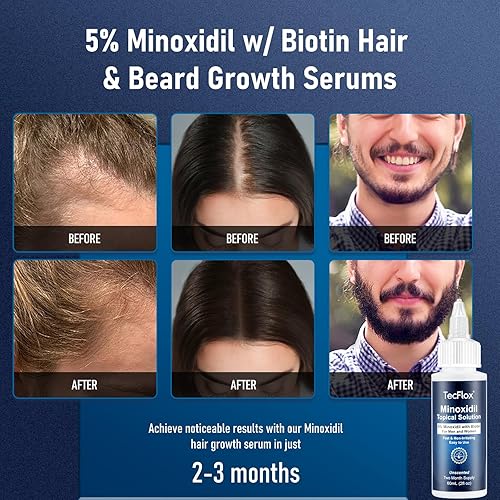 Miniatura 2 de 5% de minoxidil con biotina para hombres y mujeres, aceite de crecimiento de barba, suero de crecimiento del cabello, unisex, paquete de 2, total de