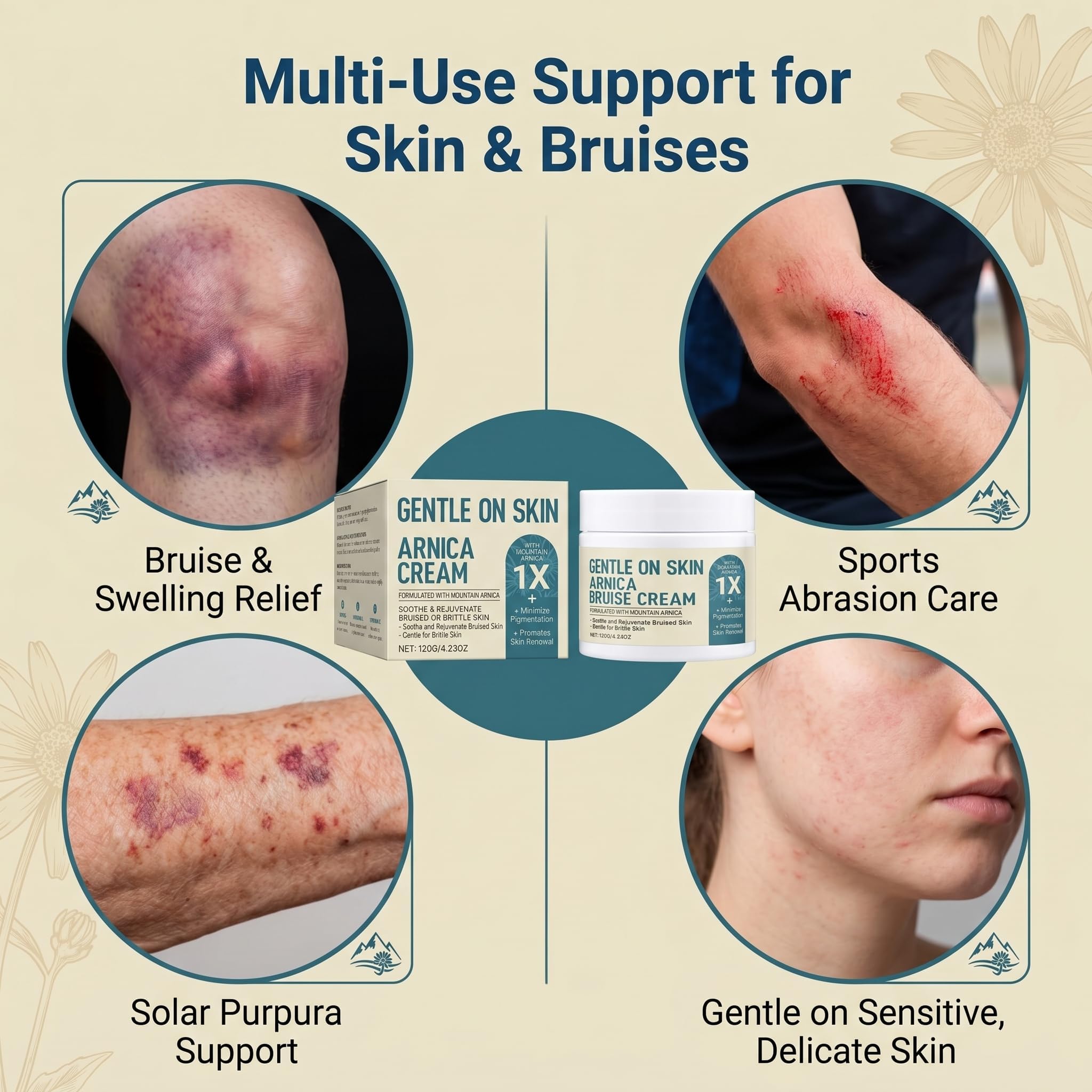 Extra Strength Arnica Bruise Cream with Vitamins K, C & E