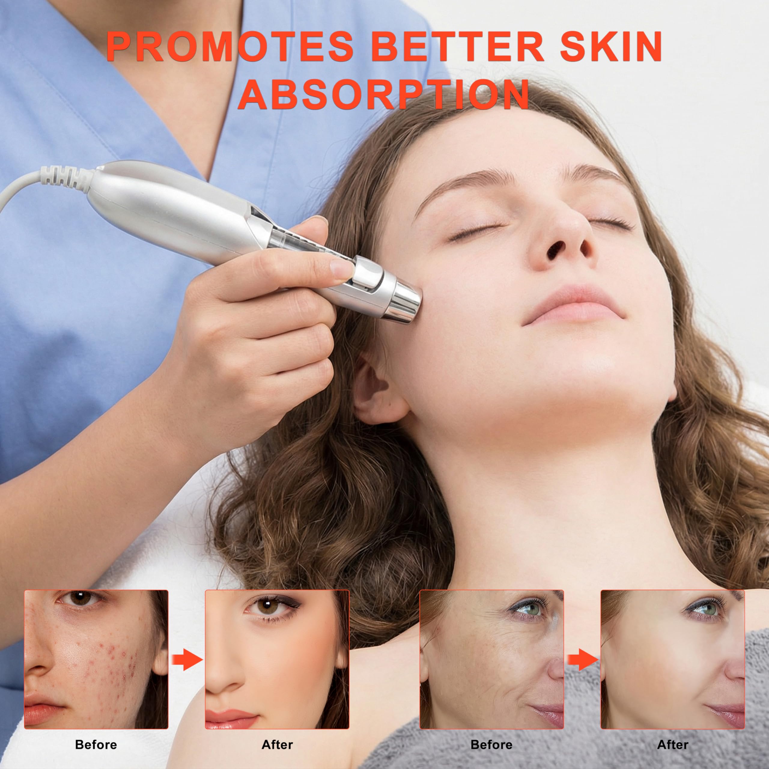 Elitzia ETF49E aguja libre de electroporación Mesoporation ion-importación de equipos de belleza facial blanqueamiento eliminación de arrugas y la hinchazón | Mesoporación, importación de iones, eliminación de arrugas, blanqueamiento e hidratación de la p