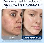 Clean Skin Club Clean Towels XL®, 100% USDA Serviette de visage bio-basée, serviette de visage jetable, Association Eczema acceptée, déshabillé Wipes sèches, Ultra Doucement, 1 Faites votre valise, 50 Ct