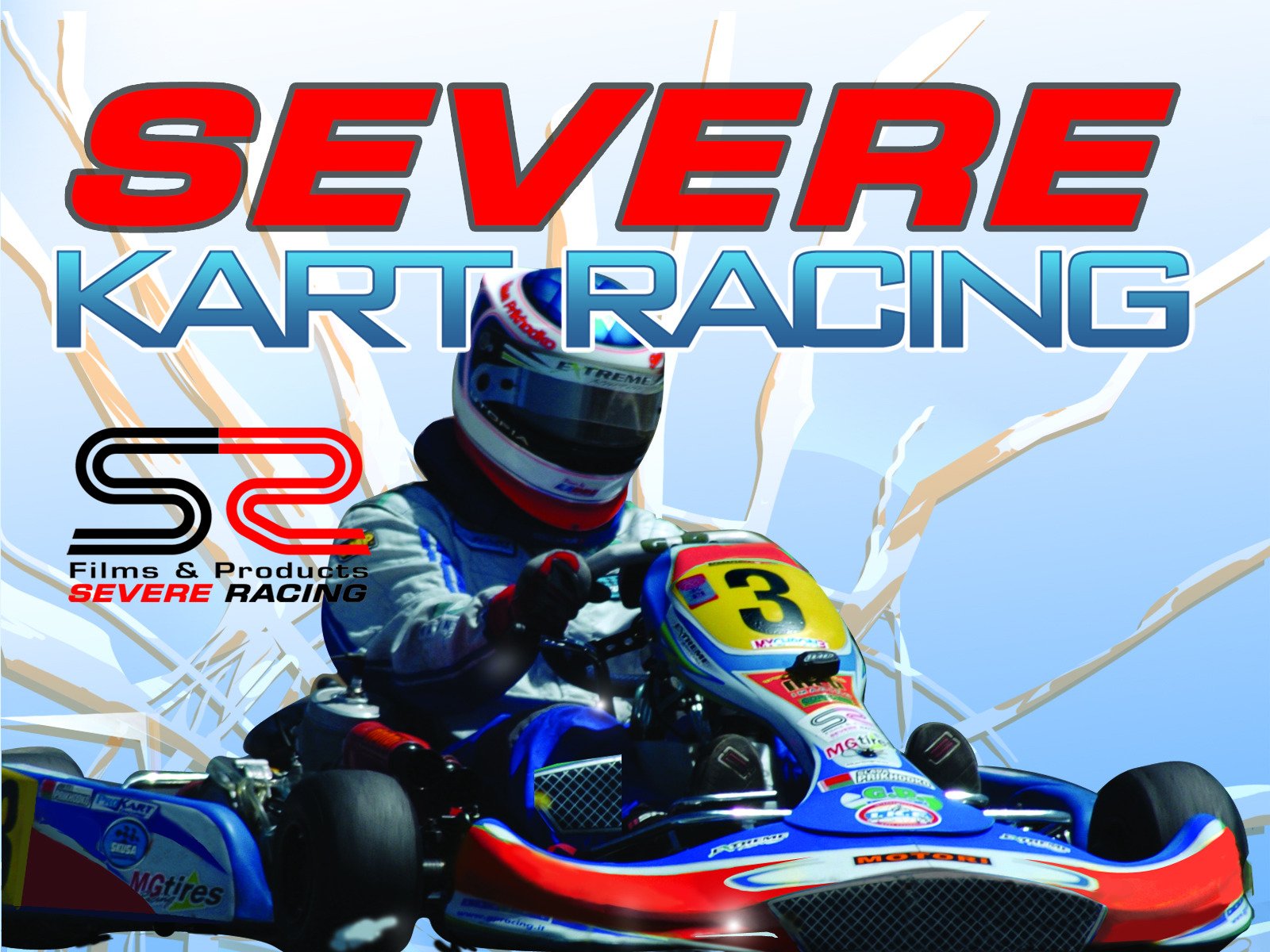 Severe Racing TV: Severe Kart Racing