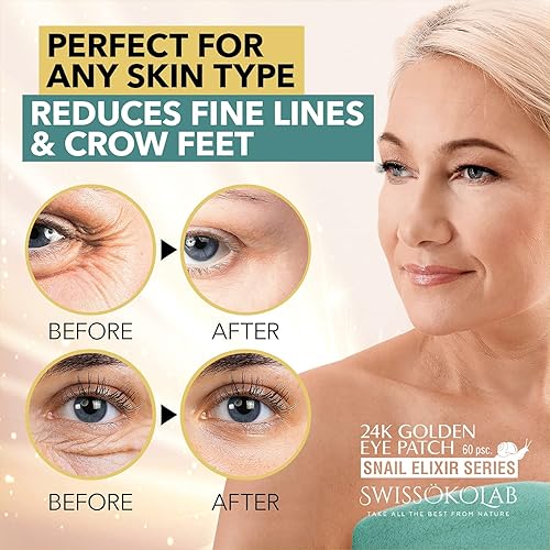 Miniatura 3 de SWISSÖKOLAB Máscara de elevación con doble mentón reductor en V + parches debajo de los ojos para ojos hinchados, máscara de ojos de oro de 24