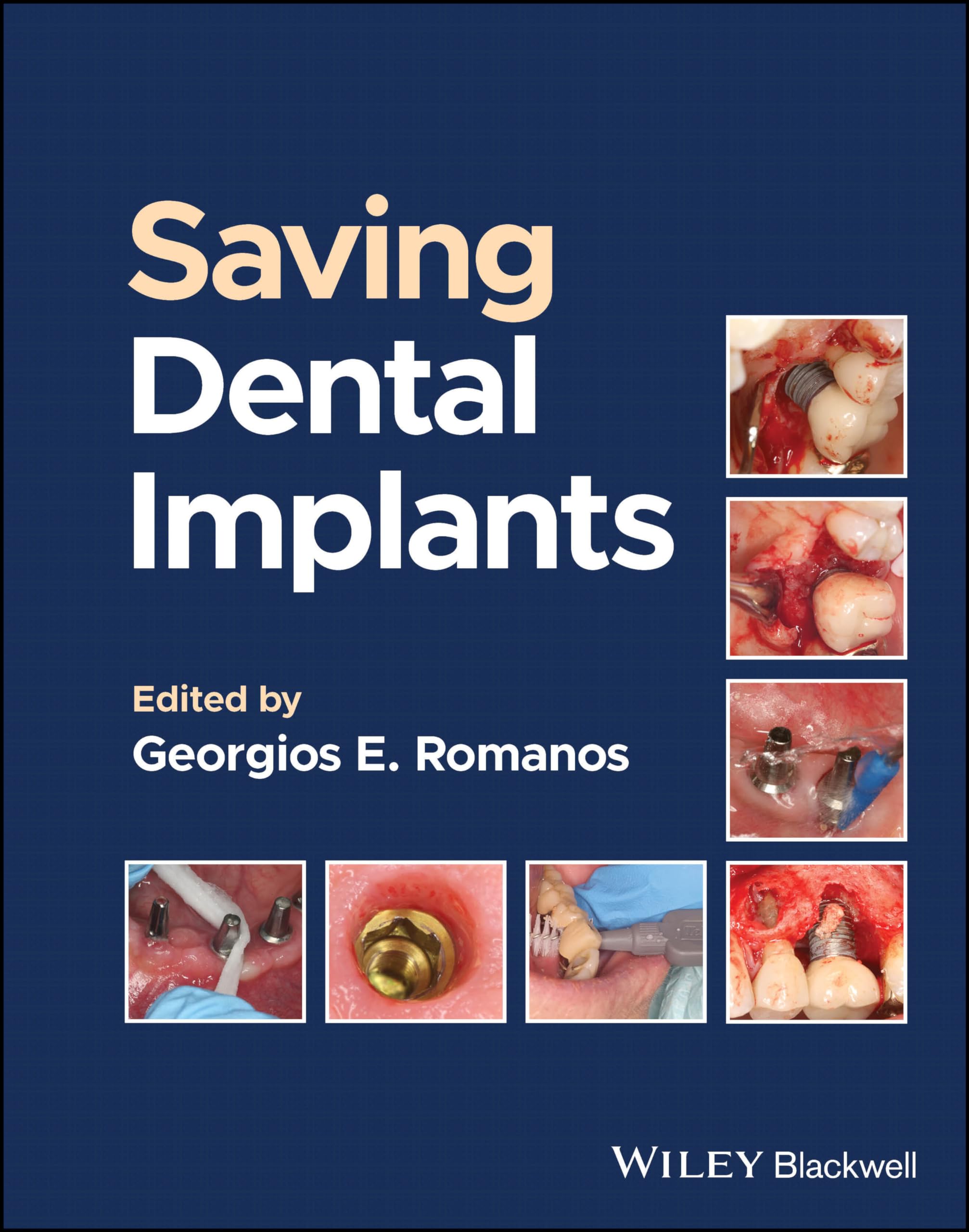 Saving Dental Implants