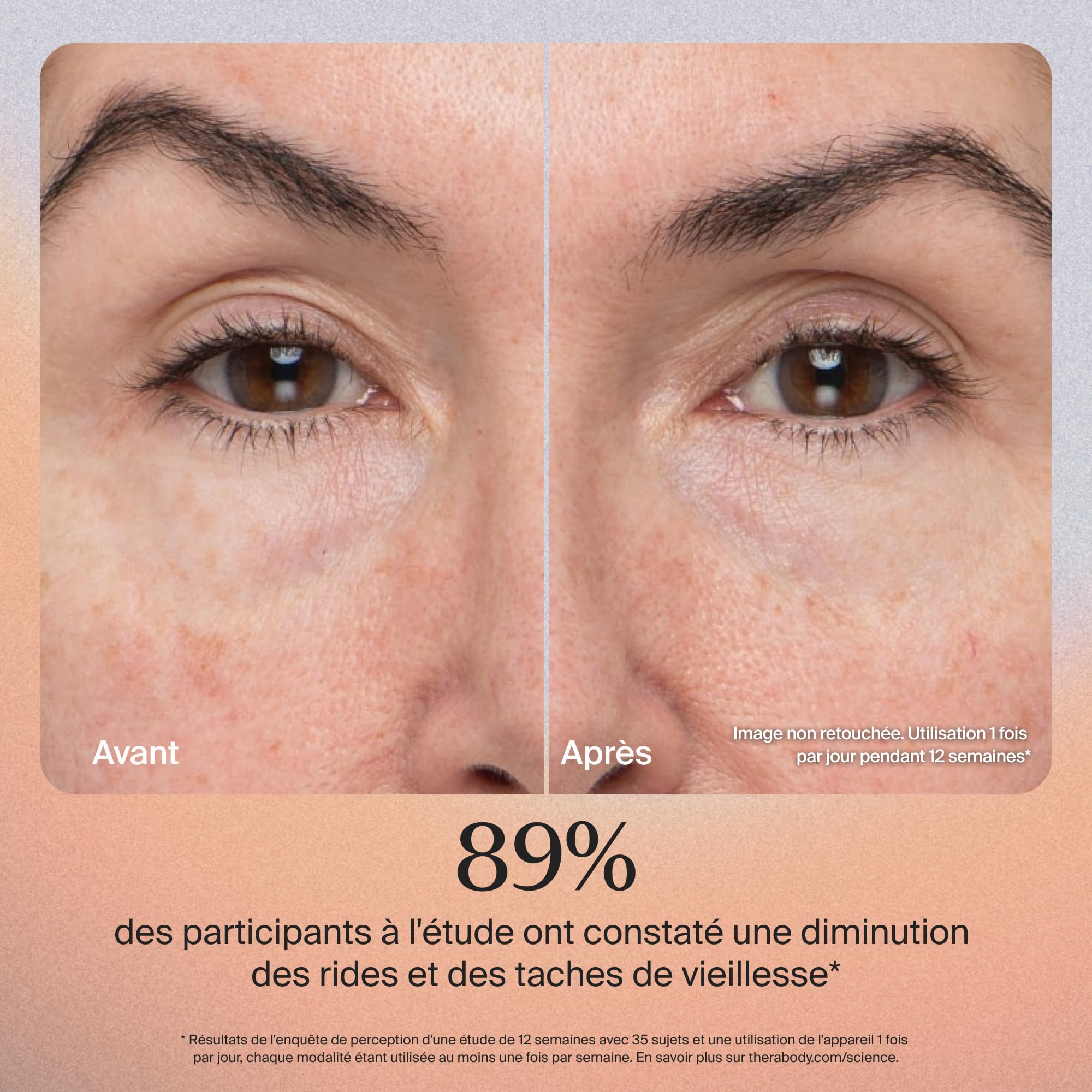 TheraFace PRO - Appareil de massage facial portable - Thérapie électrique pour le visage et les soins de la peau - Traitement 8 en 1 avec anneaux de thérapie par microcourant et lumière LED - Blanc