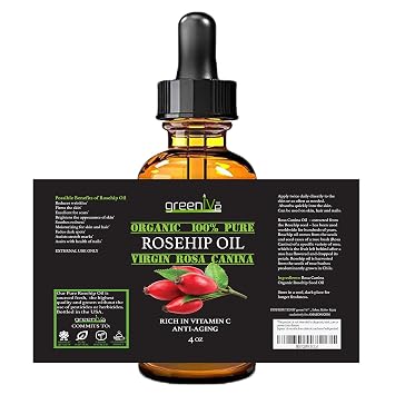 GreenIVe Rosehip Oil Rosa Canina 100% Pure Cold Pressed Virgin Oil Hair and Skin and DIY products (4oz dropper)