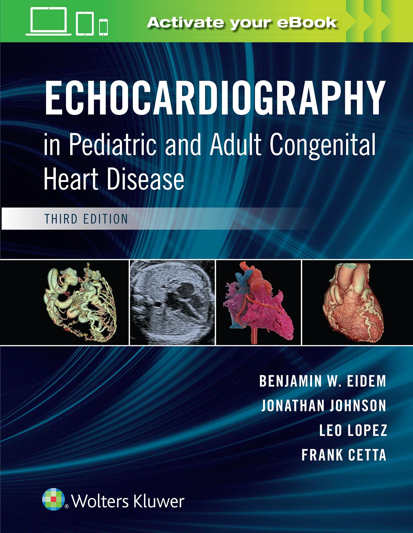 健康・医学 echocardiography in pediatric and adult 81IHxiYdZdL.jpg