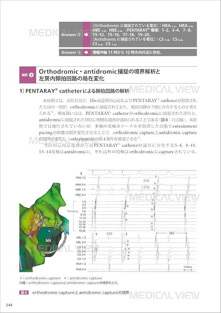 From Basic to Advanced EPS カンファレンスで学ぶ 心臓電気生理の