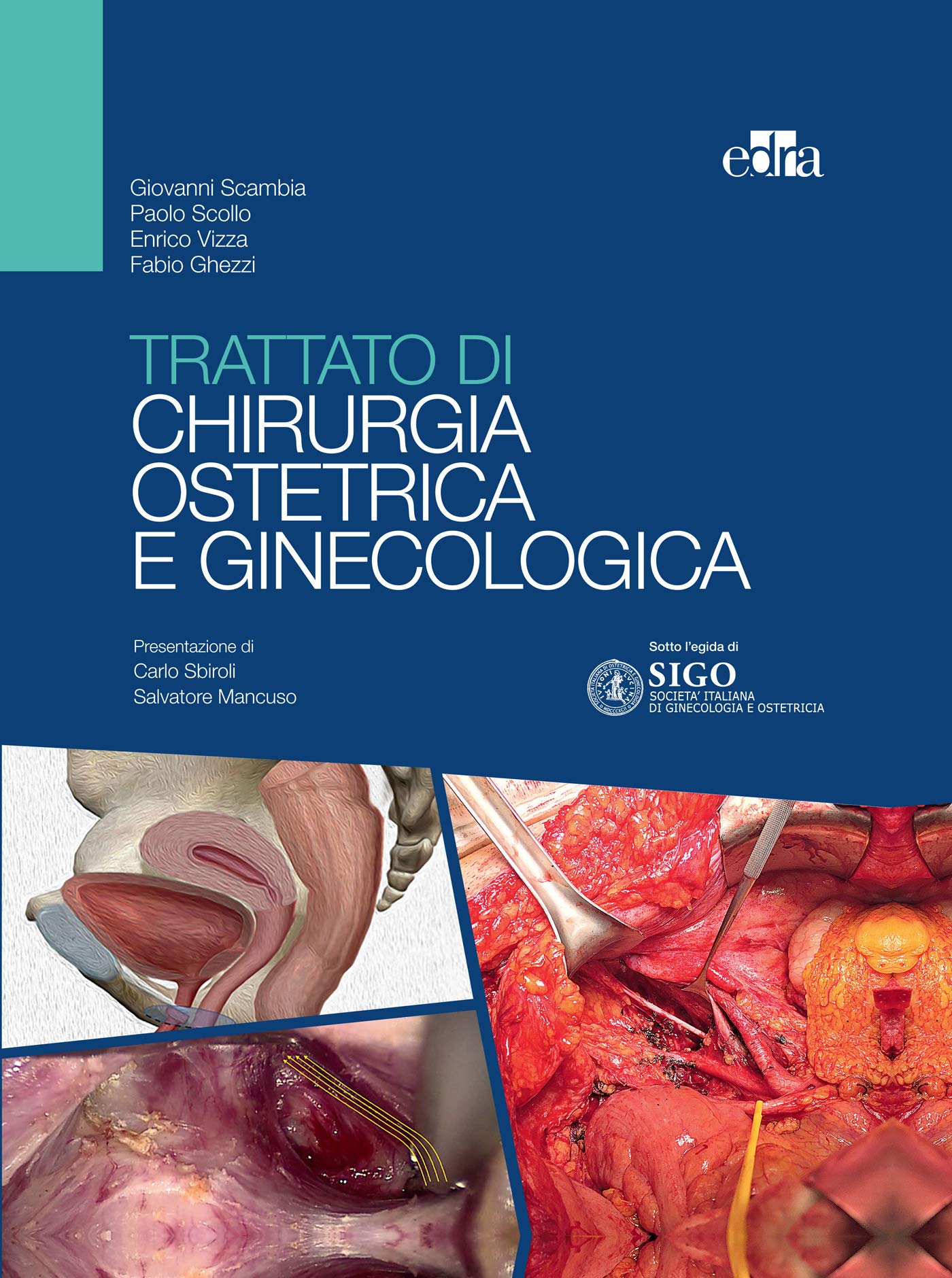 Trattato di chirurgia ostetrica e ginecologica (Italian Edition)