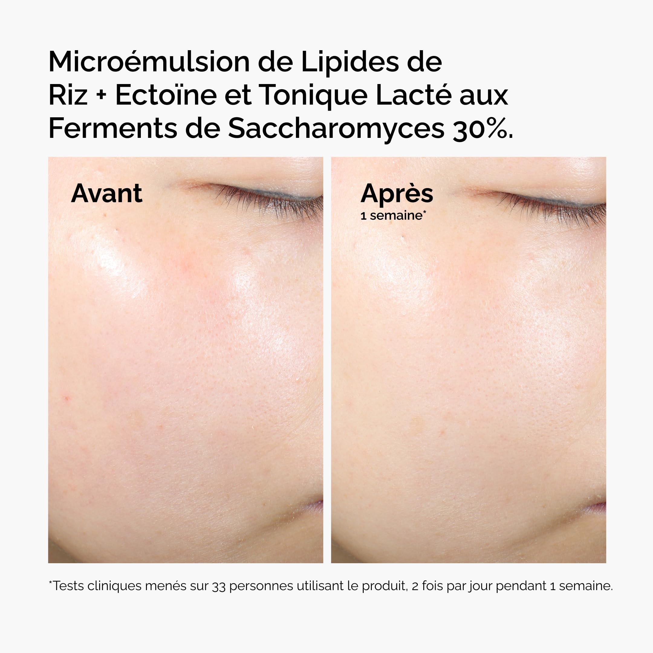 The Ordinary Rice Lipids + Ectoin Microemulsion: idratazione lenitiva per pelle secca, supporto della barriera cutanea, riduzione dei rossori, 60 ml