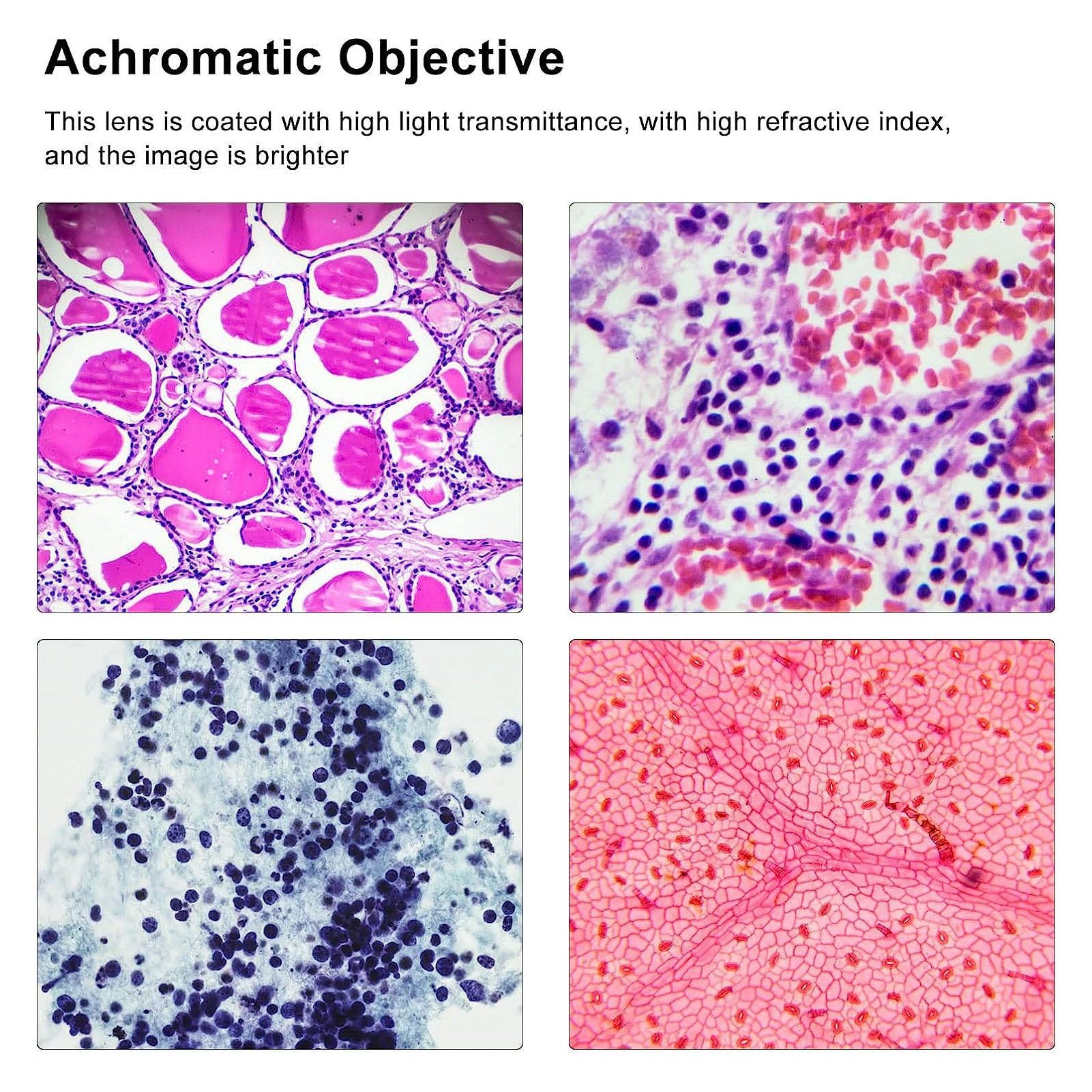 Obiettivo 40X con Rivestimento Ad Alta Trasmittanza per Immagini più Chiare Nei Microscopi Biologici