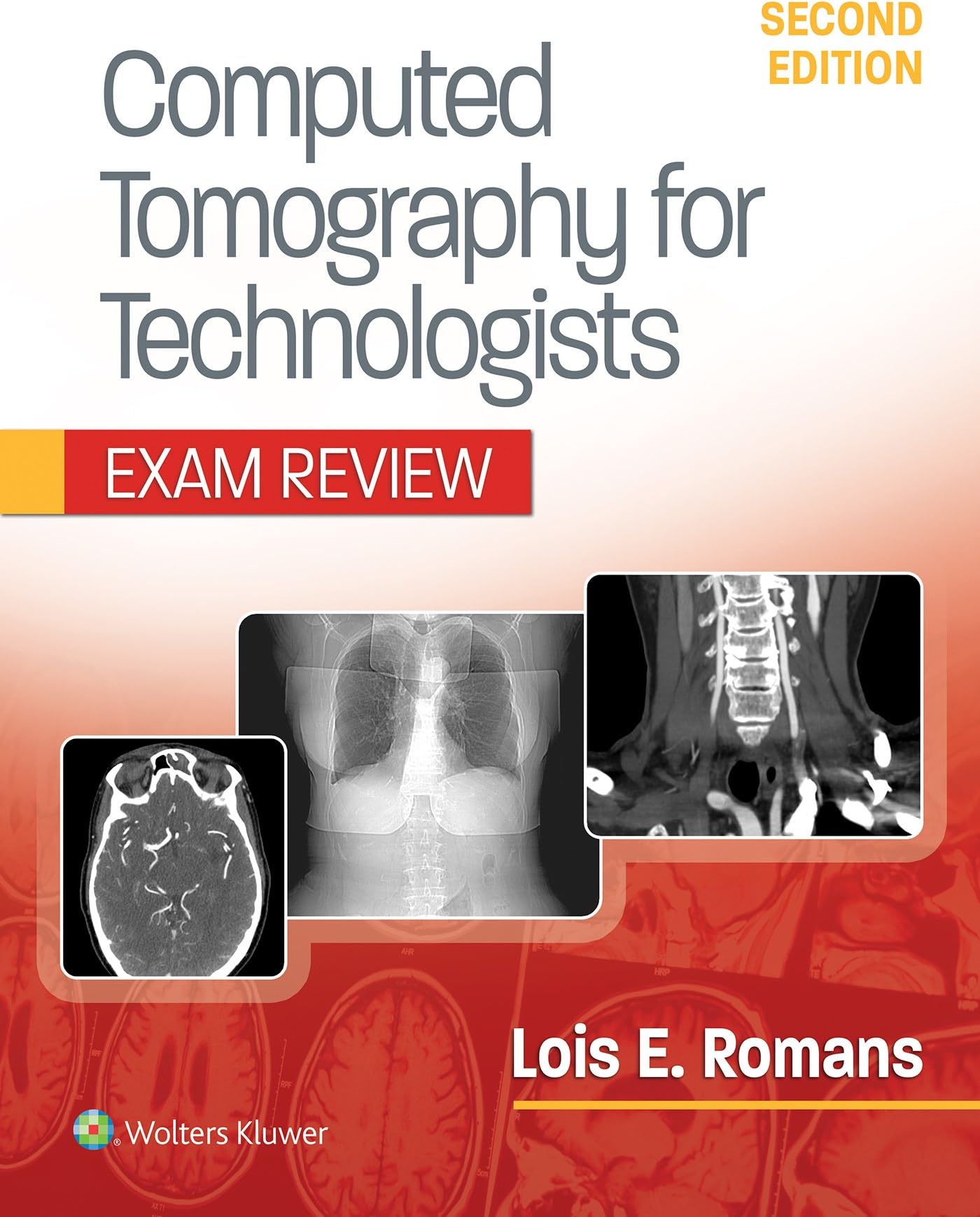 Computed Tomography for Technologists: Exam Review