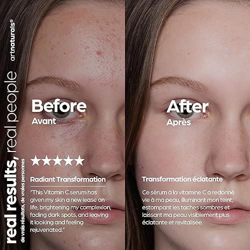 Miniatura 4 de artnaturals Anti-Aging Vitamin C Serum - (1 Fl Oz / 30ml) - with Hyaluronic Acid and Vit E - Wrinkle Repairs Dark Circles, Fades Age Spots and Sun