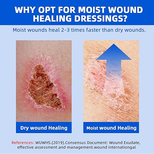 Miniatura 6 de Apósito de espuma de silicona Lite de 4 x 4 pulgadas, borde suave para heridas, incisiones quirúrgicas, quemaduras, abrasiones, apósito de grado