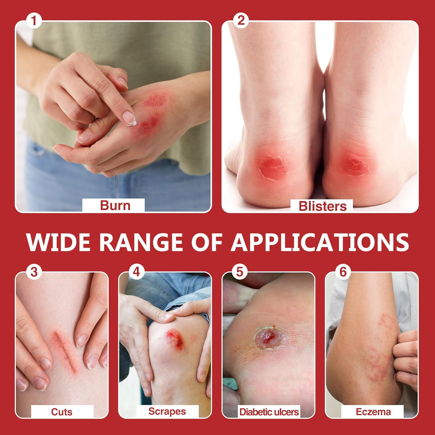 Hydrocolloid Bandages, Self-Adhesive Hydrocolloid Patch, Clean and Hygienically Sealed, Waterproof & Absorbent Dressing for Minor Burns, Blisters and Acne Care（2 in x 16 ft）