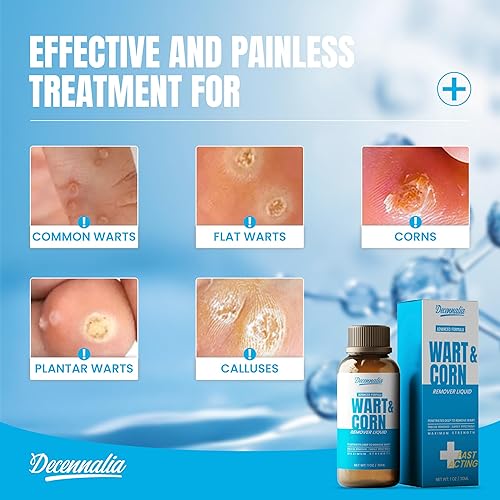 Miniatura 3 de Decennalia Eliminador de maíz de verrugas de acción rápida para pies, removedor de verrugas de ácido salicílico para hombres y mujeres, eliminación