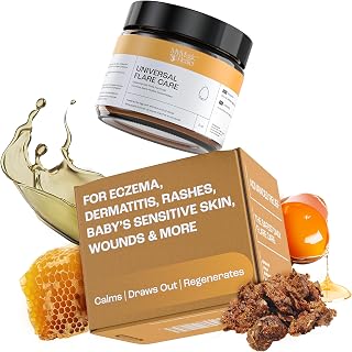MyMagicHealer Universal Flare Care | Essential Oil Free | Relief for Rashes, Eczema, Psoriasis, Hidradenitis Suppurativa, Impetigo, Dermatitis, Wound Care, Sensitive Skin w/Propolis & Egg Yolk 2 oz
