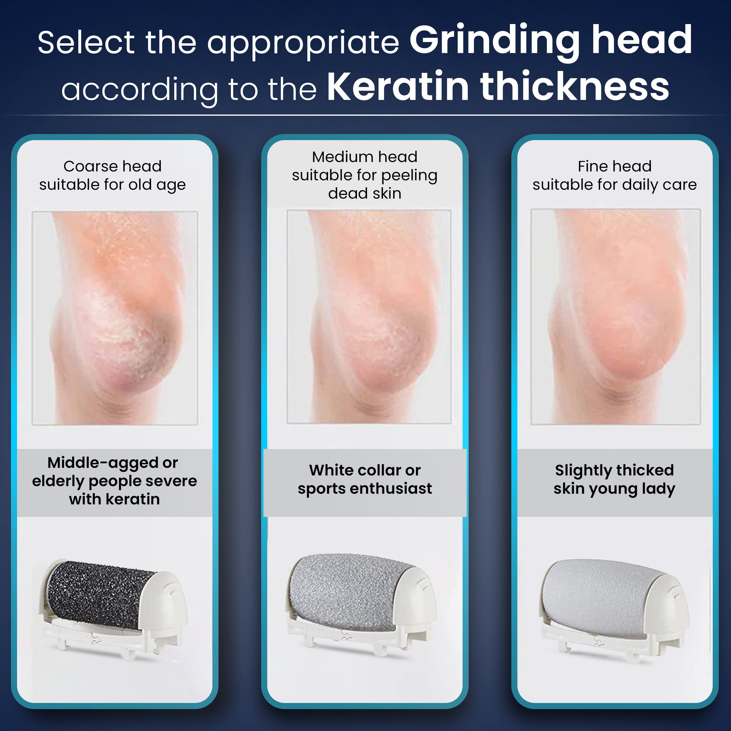 AGARO Callus Remover Replaceable Heads, 3 Pcs, Callus & Dead Skin Removal Filer, Pedicure At Home - Image 3 thumbnail