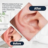 Vista 6 de Elephant Ear Washer Bottle System by Doctor Easy