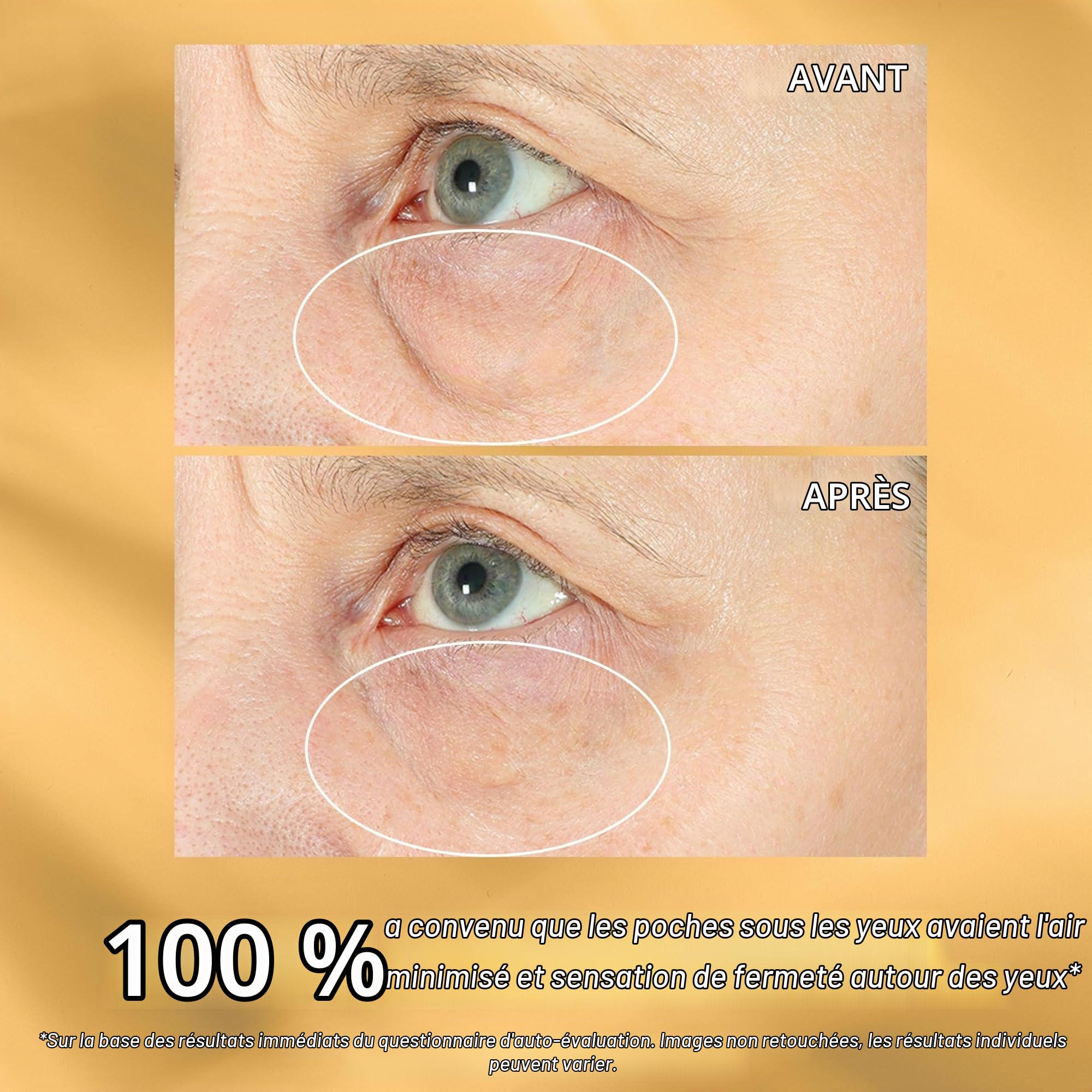 StriVectin R/L Hyperlift Correcteur Yeux Express, 10 ml