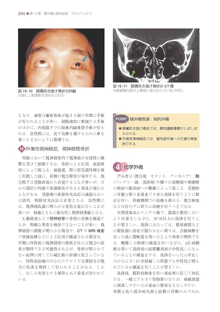 標準眼科学 第15版 Amazon.co.jp: 標準眼科学 第15版 (Standard textbook) : 中澤