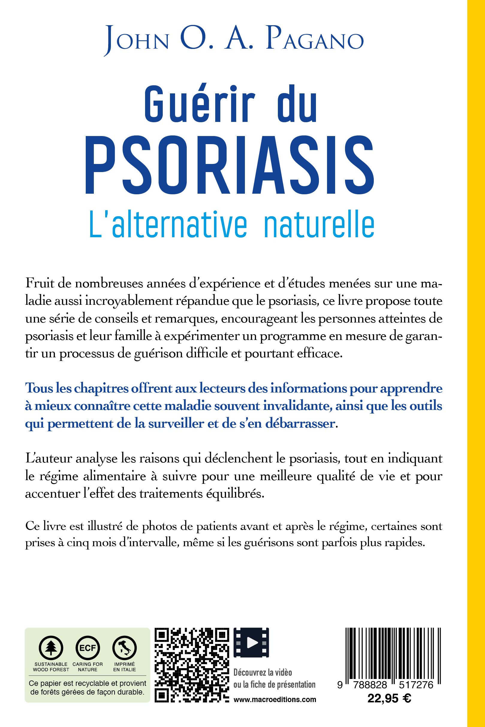 Guérir du psoriasis: L'alternative naturelle