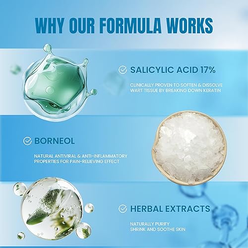 Miniatura 4 de Decennalia Eliminador de maíz de verrugas de acción rápida para pies, removedor de verrugas de ácido salicílico para hombres y mujeres, eliminación