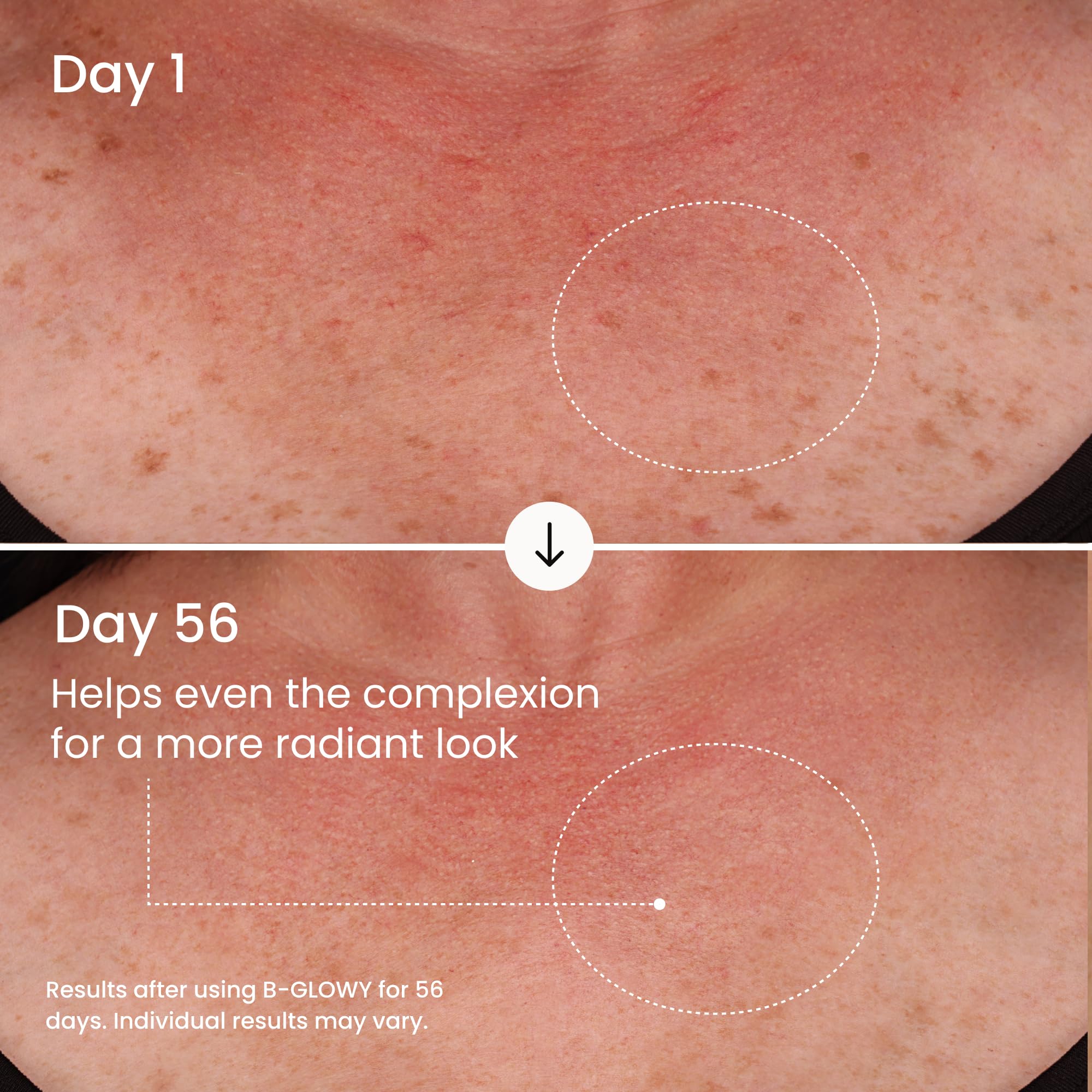 MAËLYS B-GLOWY Brightening Body Serum for Dark Spots - Supports Even Looking Skin - Peptide Formula with Niacinamide & Meadowfoam Oil (3.4 Fl Oz)