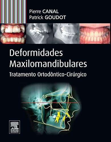 Deformidades maxilo-mandibulares: Tratamento Ortodôntico-cirúrgico