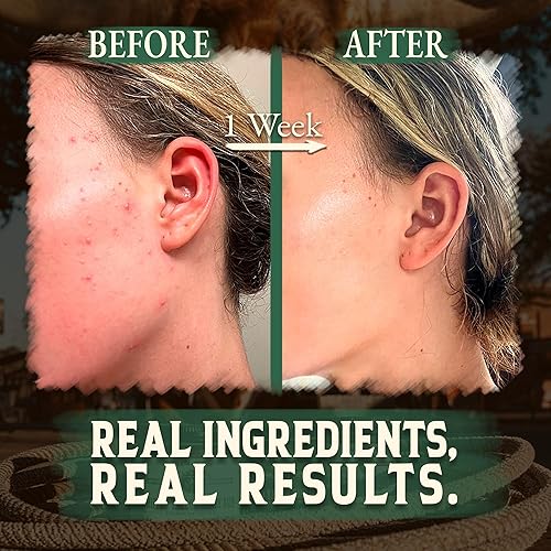 Miniatura 36 de Sarga de carne orgánica para la piel – 4 onzas (sin perfume) – Sarga de carne alimentada con pasto para cara + cuerpo – Crema hidratante de bálsamo