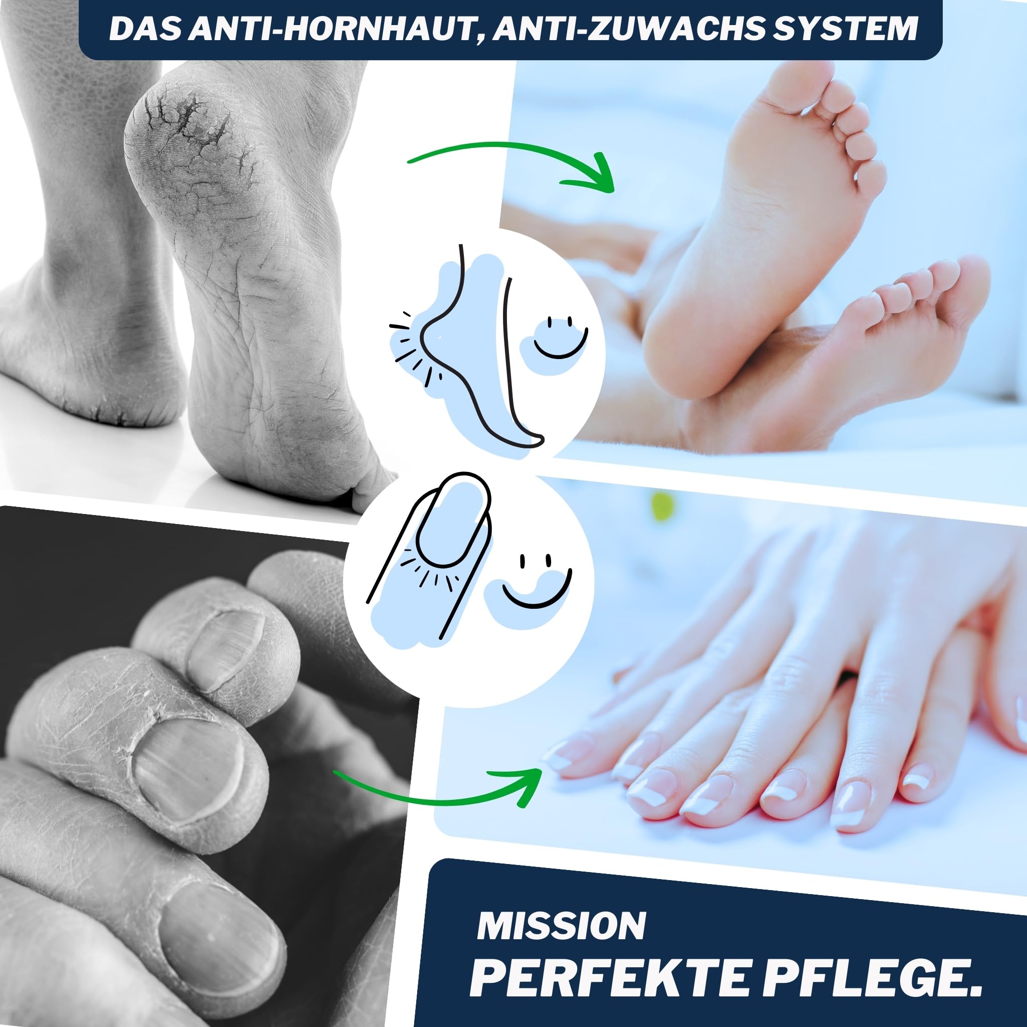 Mr. Fuss® Starter Kit 7-teilig Edition Excell Hornhautentferner Systempaket für sanfte Entfernung auch für Maniküre