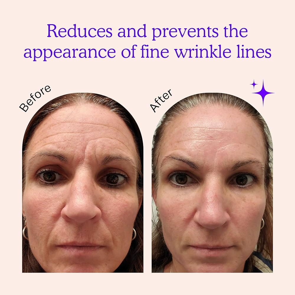 Amazon.com : BLUMBODY Face, Forehead Wrinkle Patches - Anti