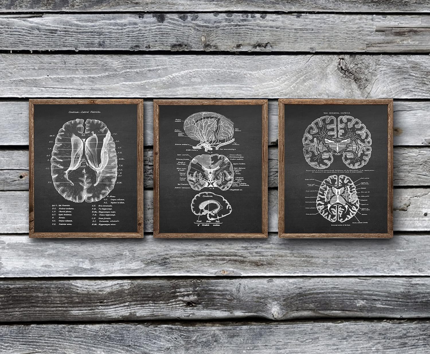Gnosis Picture Archive Neuroscience Wall Decor Poster Brain Anatomy set of 3 unframed Art Prints
