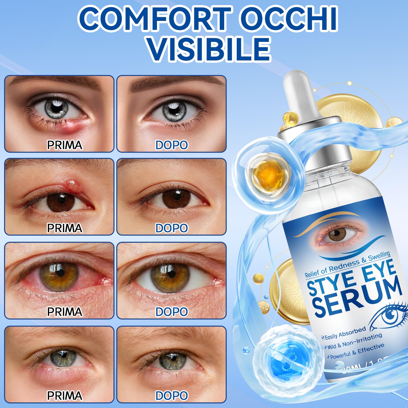 Siero Oculare per Orzaioli, Siero Naturale per Occhi, Adatto a Orzaioli, Blefarite, Calazi e Secchezza Oculare, Pulizia quotidiana occhi, Allevia la Secchezza, Dona Una Pelle Più Sana