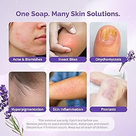 Naturasil Sulfur Soap Treatment w/Pure Lavender | Max-Strength Natural Relief for Acne, Mites, Bug Bites, Warts, Eczema, Itching | for Kids & Adults: Face & Body Soap (2) 4oz Bars