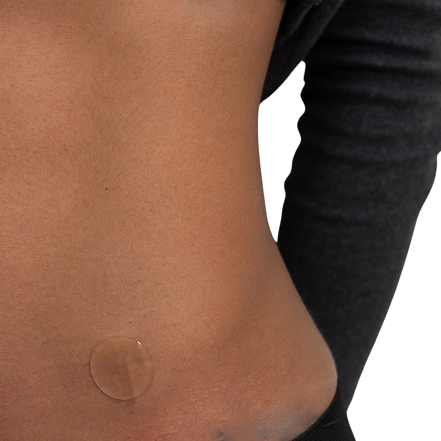 Liposuction Recovery Kit - Before, After, CALMg, Arnica, Supply Kit, Scar Shield Dots