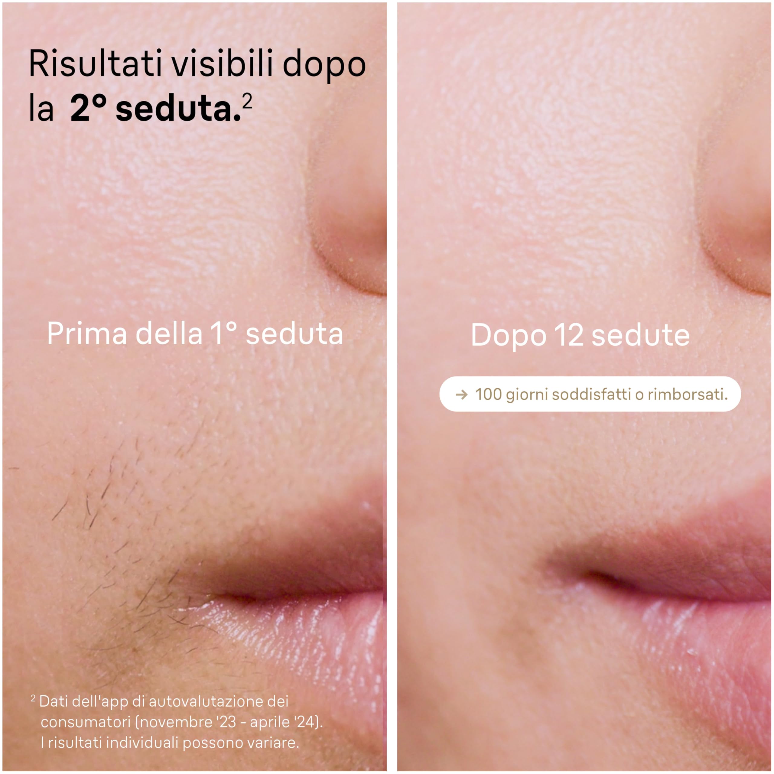 Braun Silk·Expert Pro 5 Epilatore Luce Pulsata, Depilatore Corpo Donna, Alternativa al Laser Peli, con Custodia, Rasoio Donna Venus, 2 Testine, Luce Pulsata Braun, Idea Regalo, Bianco/Bronzo, Pl5152