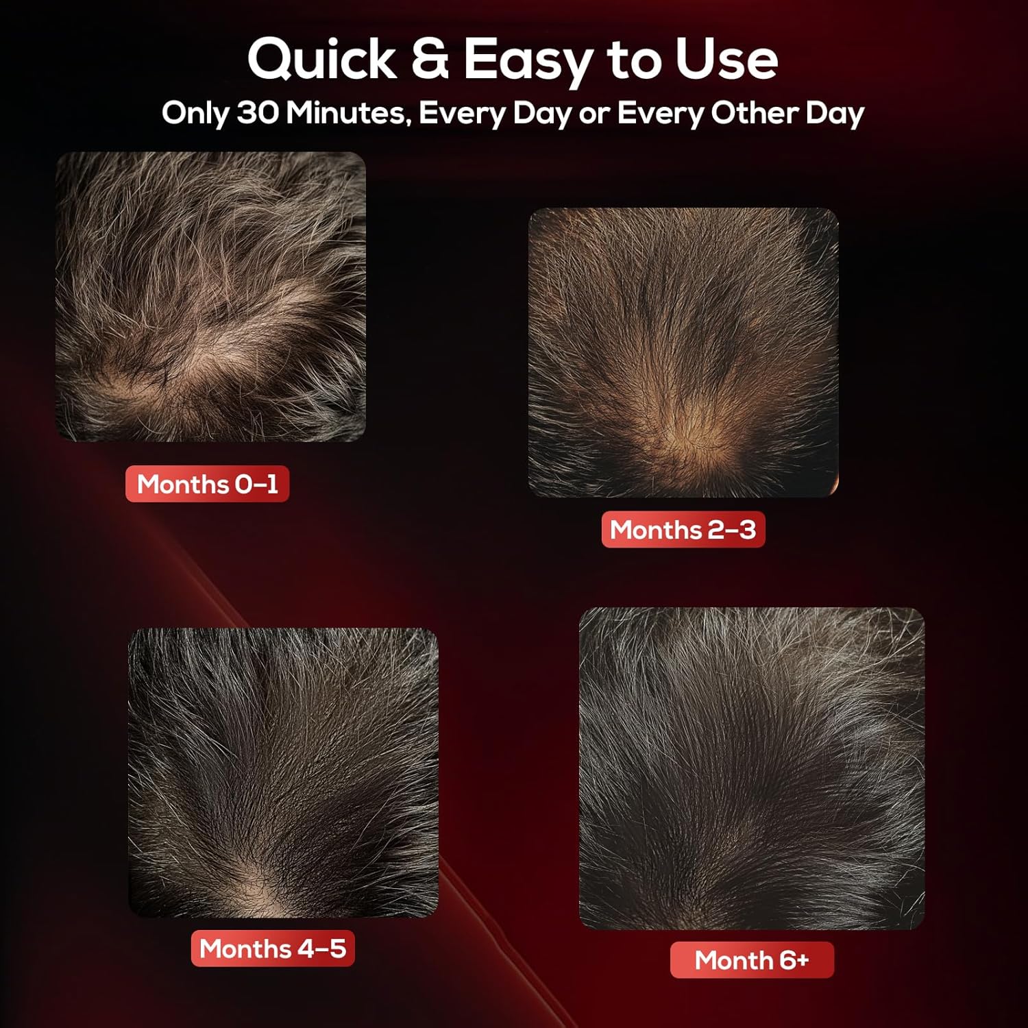 Laser Hair Growth Cap, Low Level Laser Therapy (LLLT) Device Designed to Promote Hair Growth in Women and Men,Laser Cap