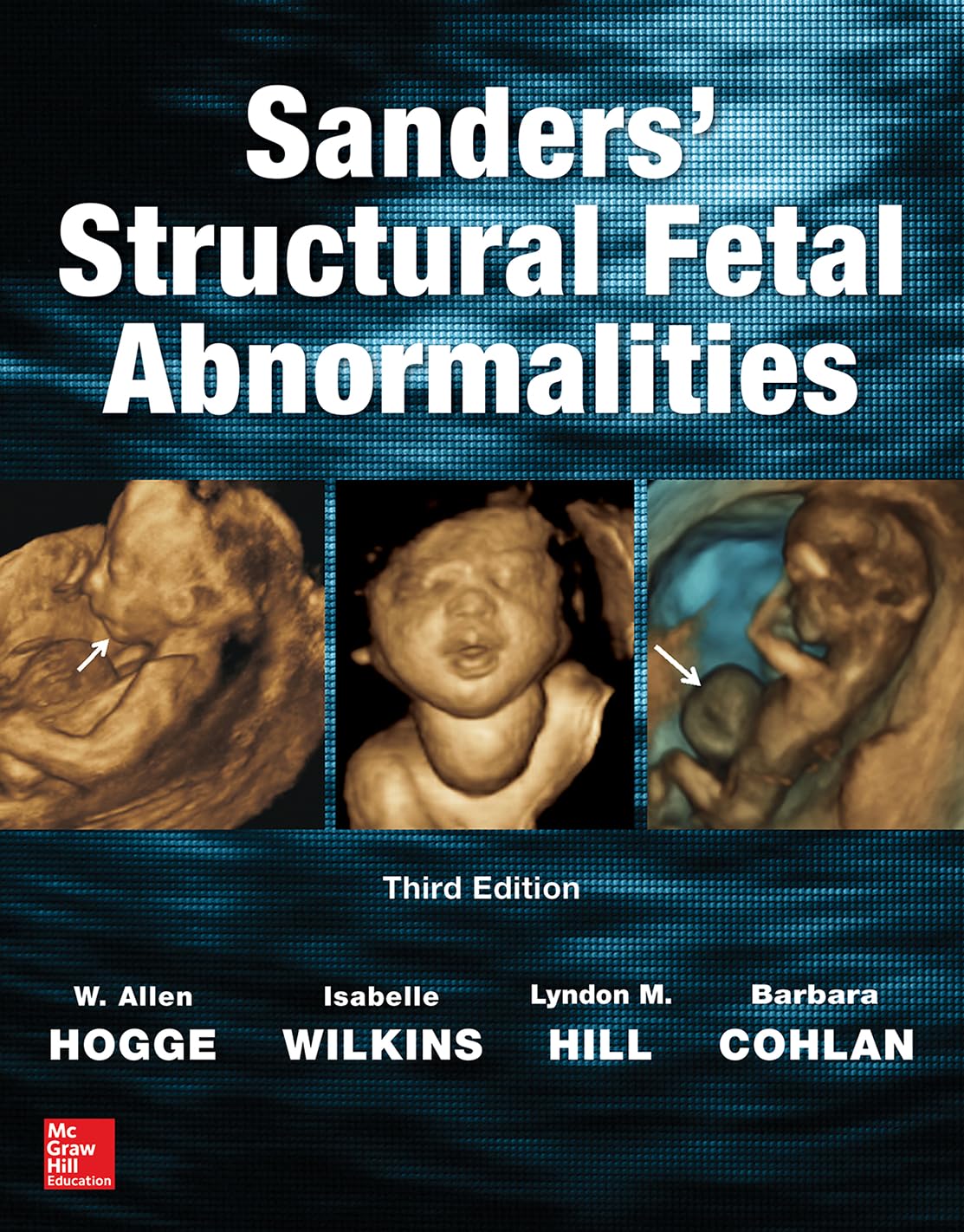 Sanders' Structural Fetal Abnormalities, Third Edition      3rd Edition