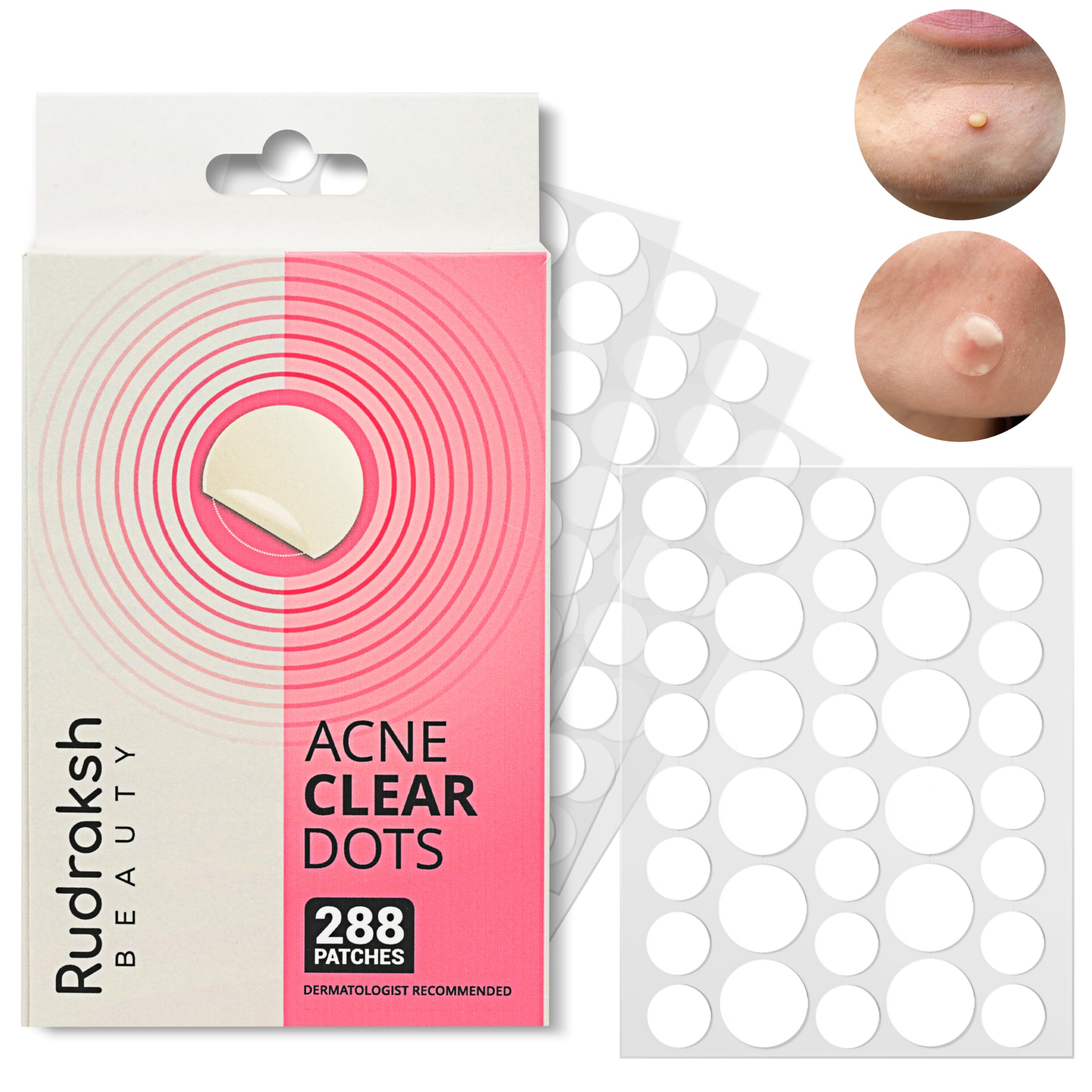 Rudraksh Pimple Patches for Face 288 Counts Hydrocolloid Pimple Patches Invisible Patches for Face Not Tested On Animals