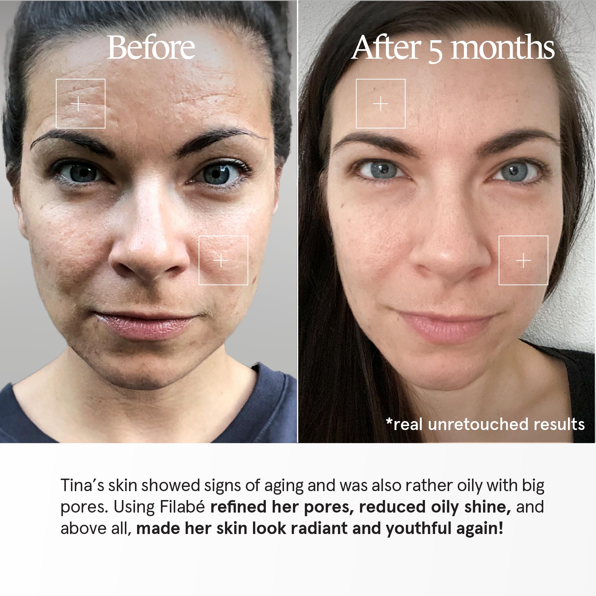Aging Skin – Zur Reduktion von Falten. Verlangsamt die Hautalterung. Packung für 28 Tage. Vegan und ohne Zusatzstoffe – Swiss made by Filabé of Switzerland