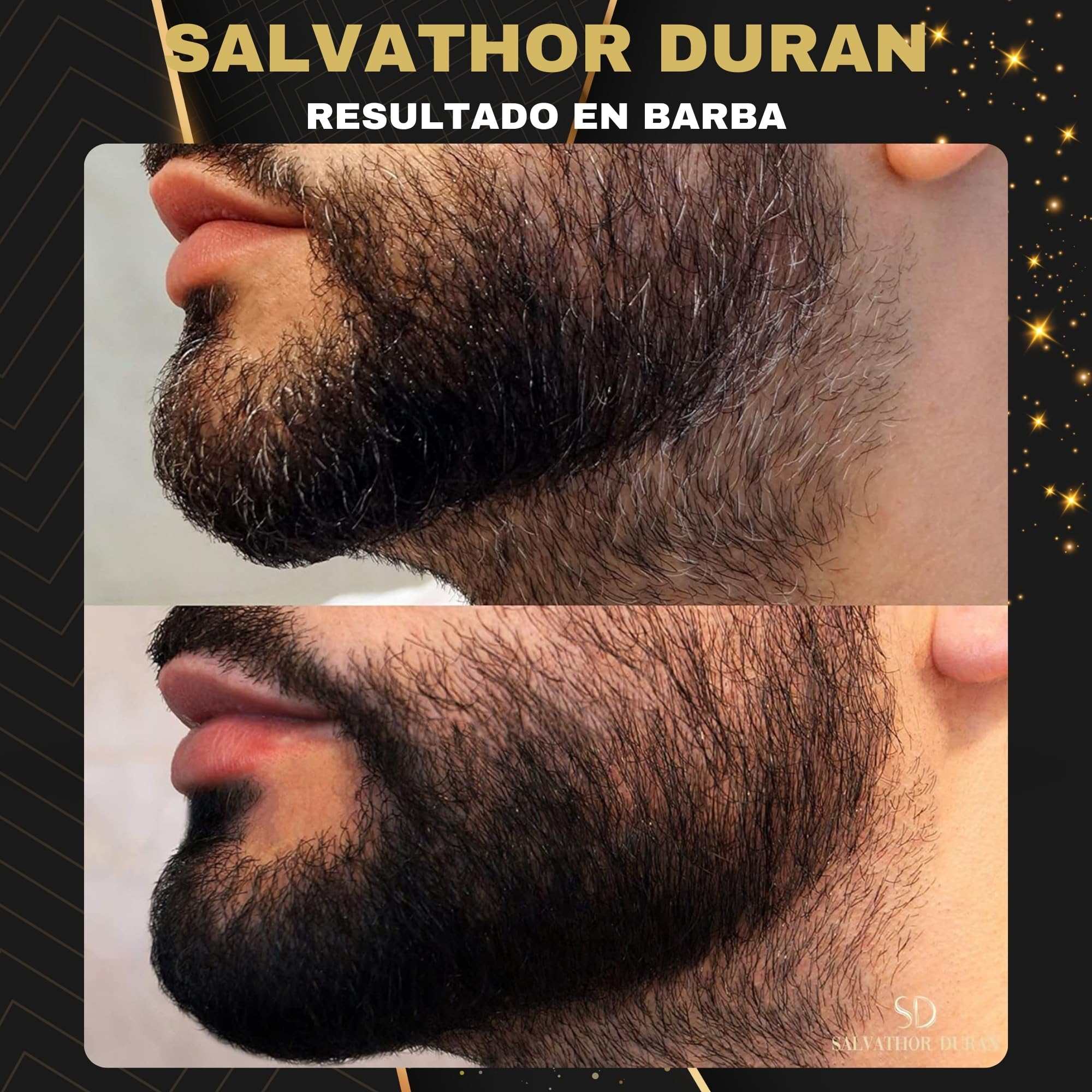 Tinte Barba Hombre - Tinte Barba - Champu Anticanas Hombre - 20 Aplicaciones - Con Protector de Barba - Salvathor Duran - 250 ml.