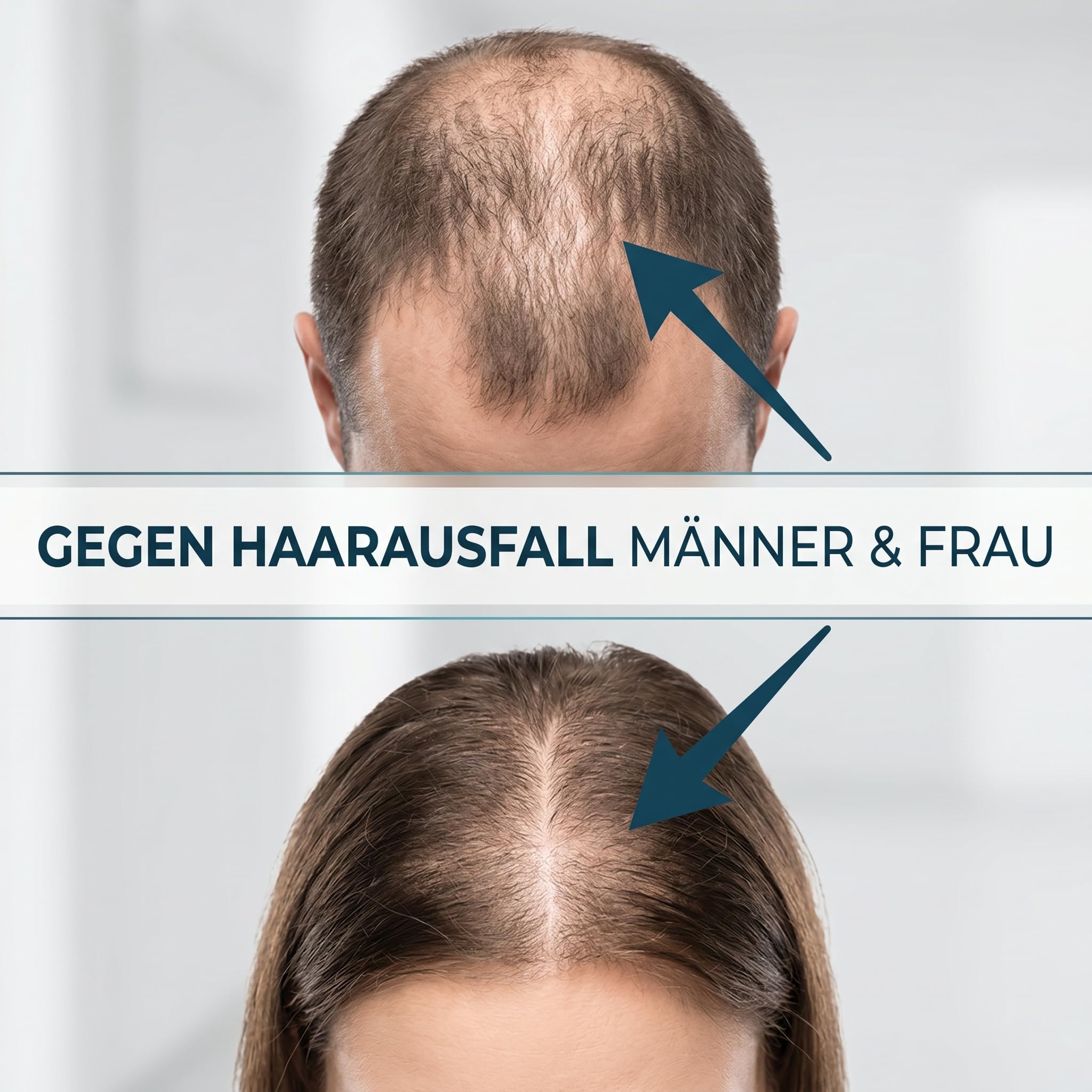 Hair Growth Spray, 60 ML Haarwachstum Spray, Natürlich Haarwachstum Beschleunigen, Stärkt die Haarfollikel, Beschleunigt das Hair Growth, Haarausfall Vorbeugen für Frauen & Männer