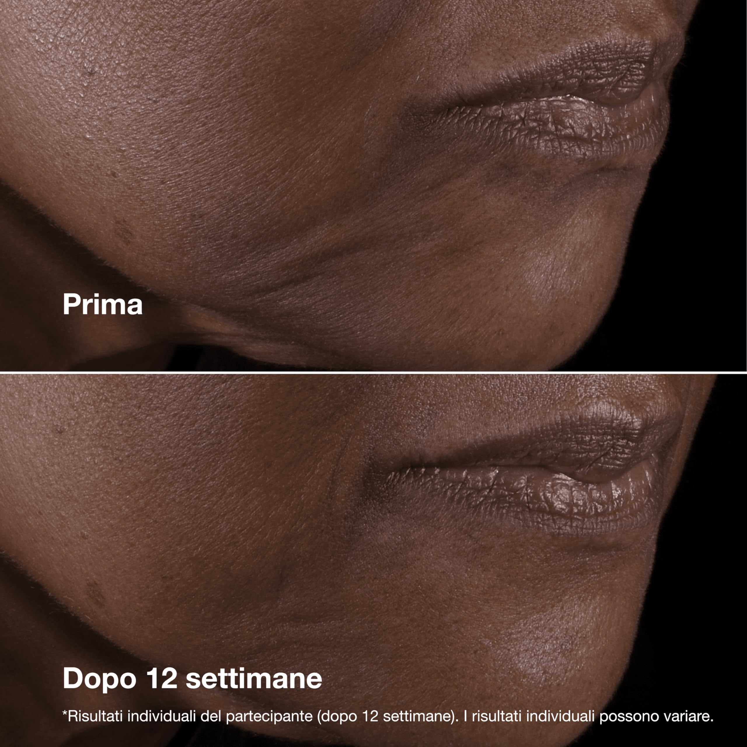 Clinique Smart Clinical Repair Lifting Face + Neck Cream | Crema idratante viso e collo anti-età, 50 ml