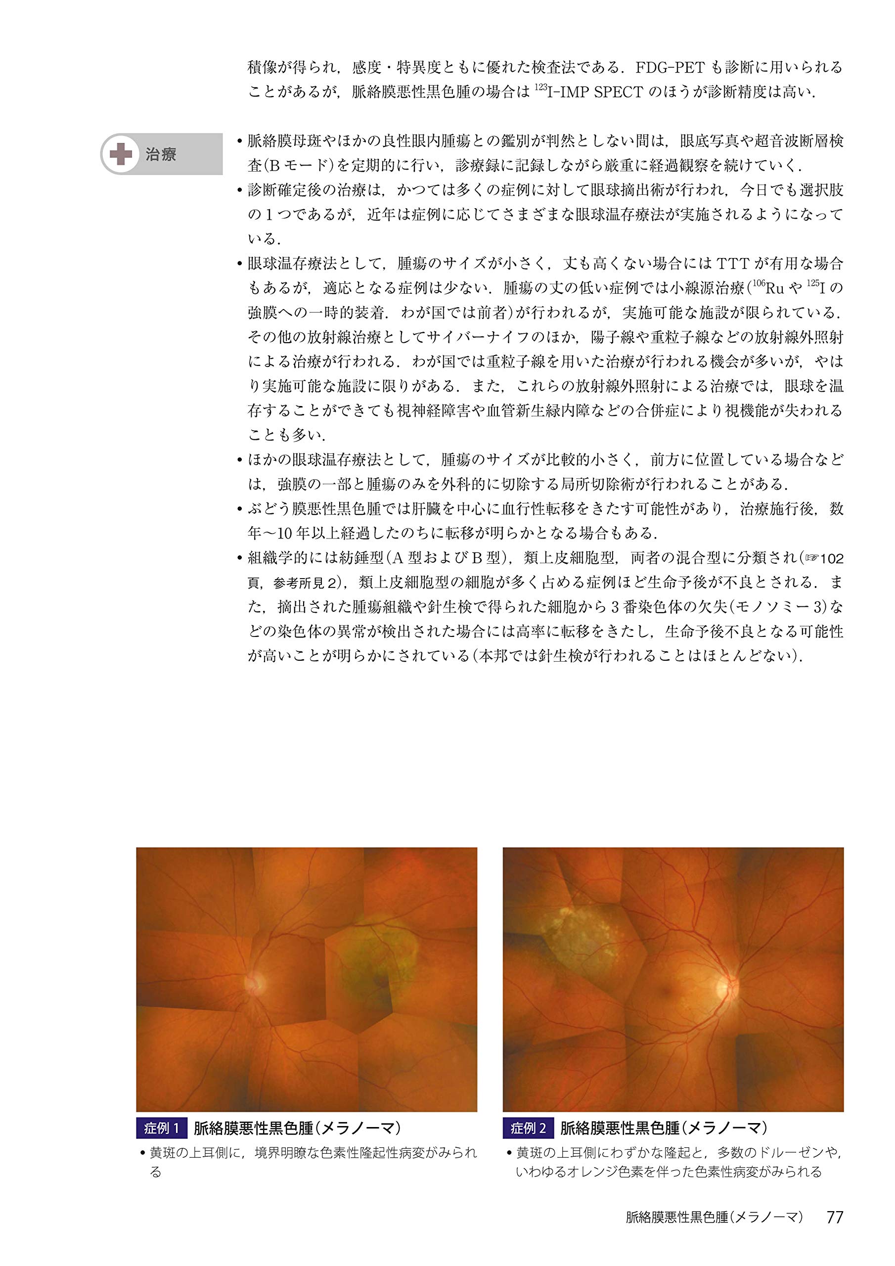 激安通販新作 眼内腫瘍アトラス 新品 asakusa.sub.jp