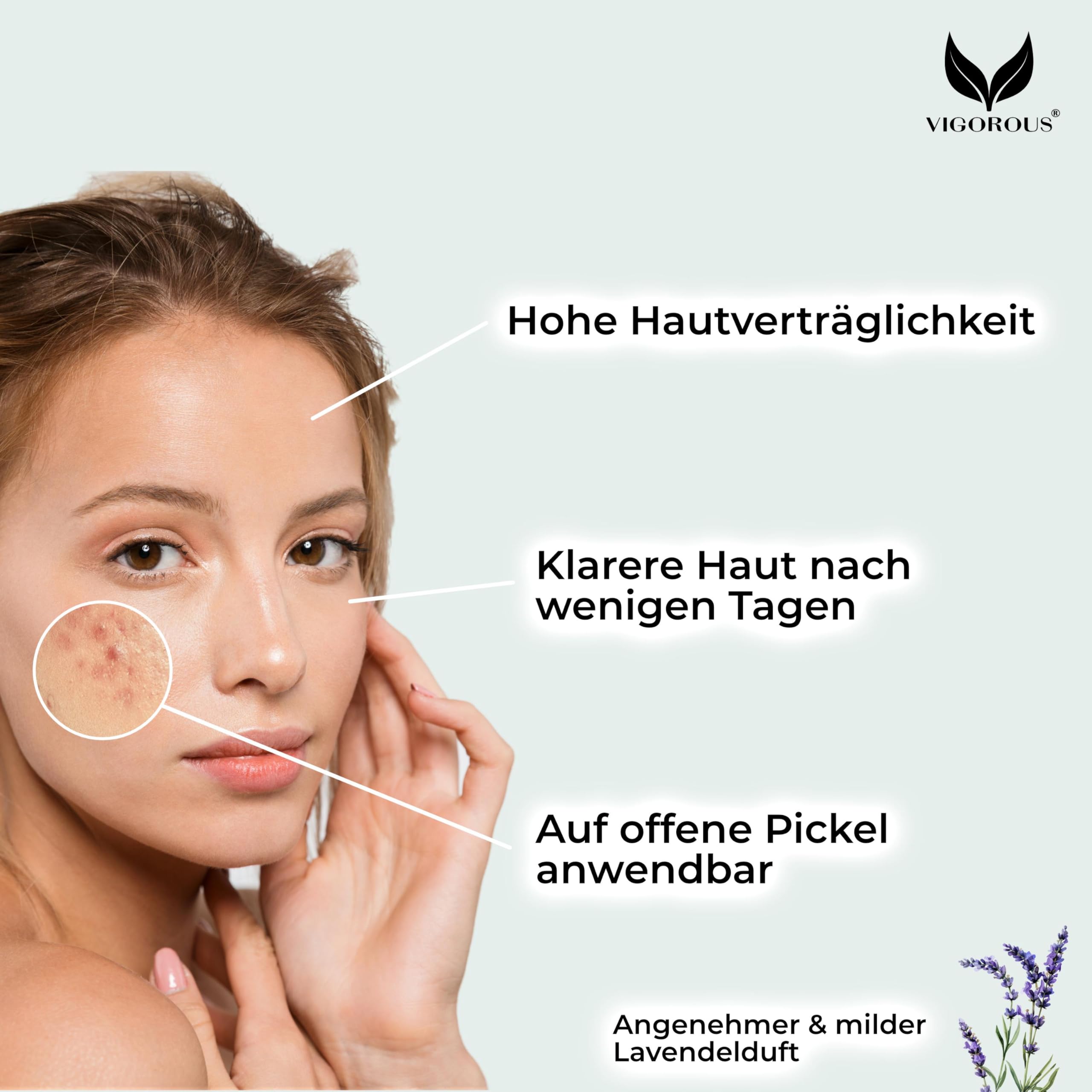 VIGOROUS® Zinksalbe gegen Pickel 60ml - Anti Pickel Creme auch für Pickel am Po und Rücken -mit Teebaumöl & Salicylsäure - SOS Zink Salbe gegen Mitesser und unreine Haut - Zugsalbe Pickel - Akne creme