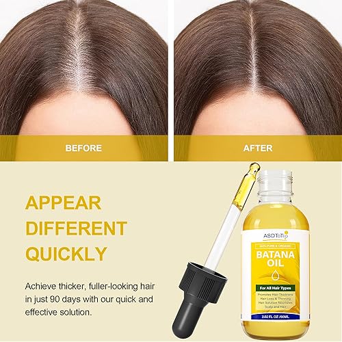 Miniatura 4 de Aceite de batana crudo para el crecimiento del cabello, 100% orgánico y natural, aceite de Dr. Sebi Batana - Previene la pérdida de cabello, hidrata