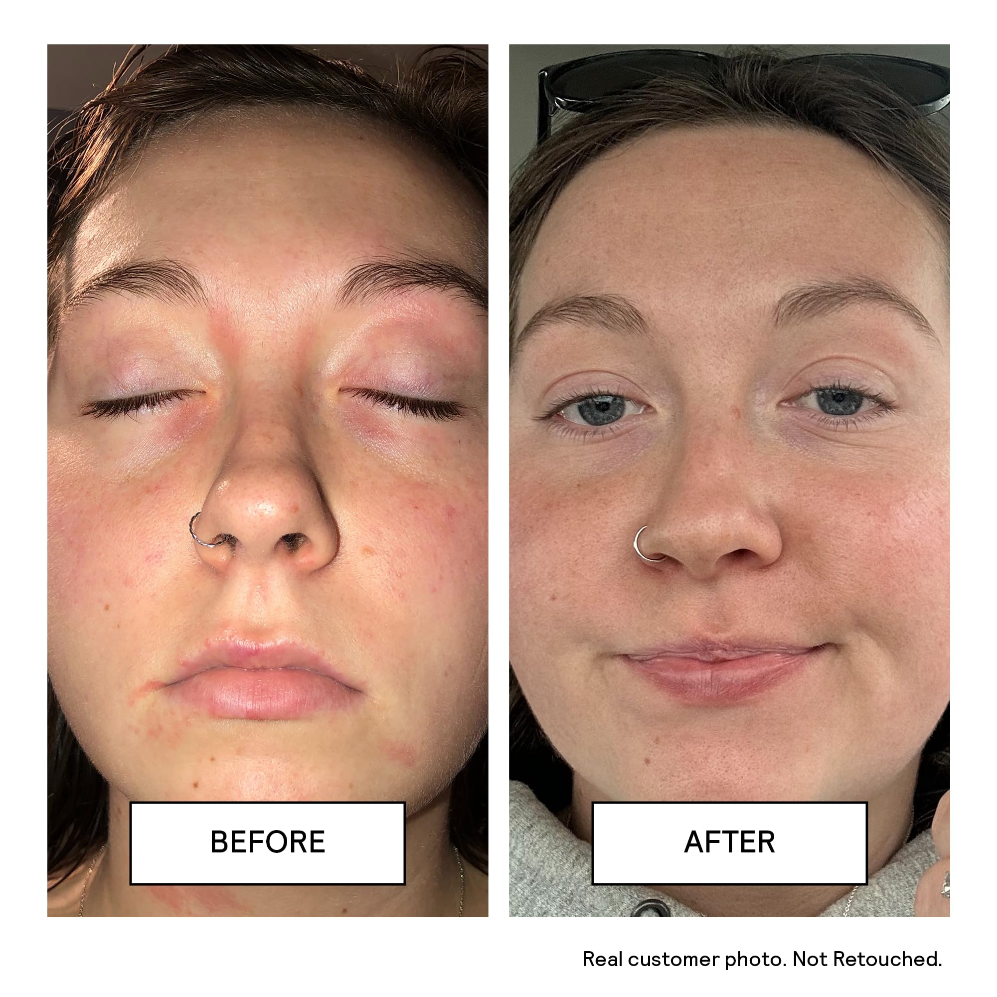 Untoxicated Gesichtsreiniger, sanfter und feuchtigkeitsspendender Gesichtsreiniger für empfindliche Haut, Ceramide, Hyaluronsäure und Glycerin, keine häufigen Reizstoffe, schäumt nicht, seifenfrei