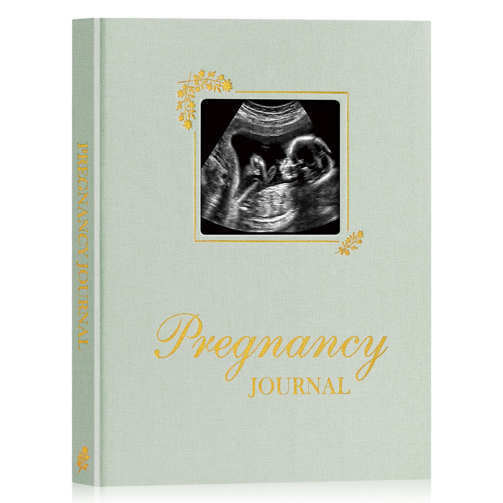 Lanpn My Pregnancy Journal Memory Book for First Time Mom 156 Page Pregnant Announcement Must Have Planner